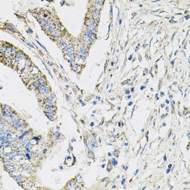 Autophagy Antibodies Anti-PI3 Kinase p110 beta Antibody CAB0982