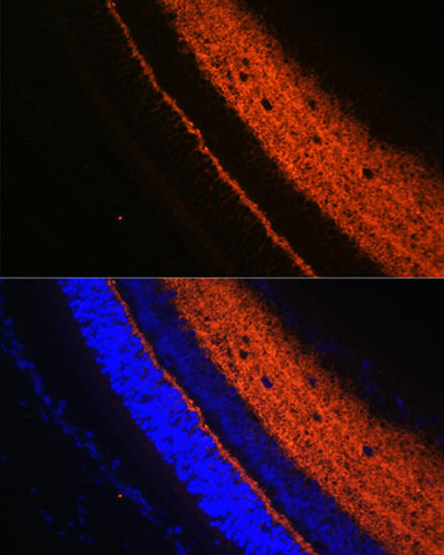 Developmental Biology Anti-SYT1 Antibody CAB0992