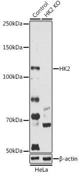 KO Validated Antibodies 1 Anti-HK2 Antibody CAB0994KO Validated