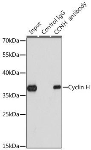 Cell Cycle Antibodies 1 Anti-Cyclin H Antibody CAB0995