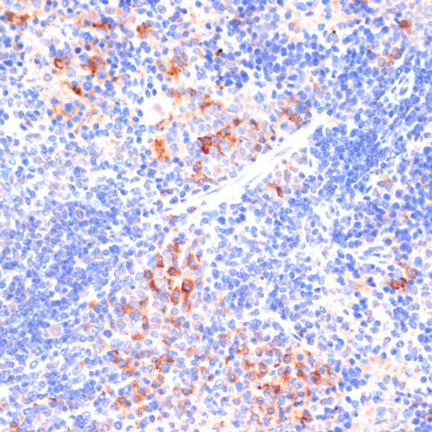 Cell Biology Antibodies 1 Anti-ARRB1 Antibody CAB0998