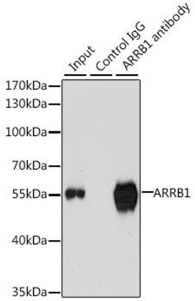 Cell Biology Antibodies 1 Anti-ARRB1 Antibody CAB0998