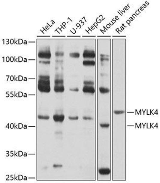 Cell Biology Antibodies 1 Anti-MYLK4 Antibody CAB10000
