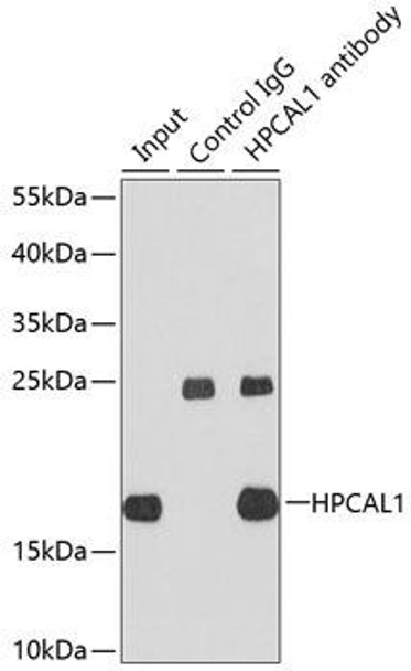 Cell Biology Antibodies 1 Anti-HPCAL1 Antibody CAB10019