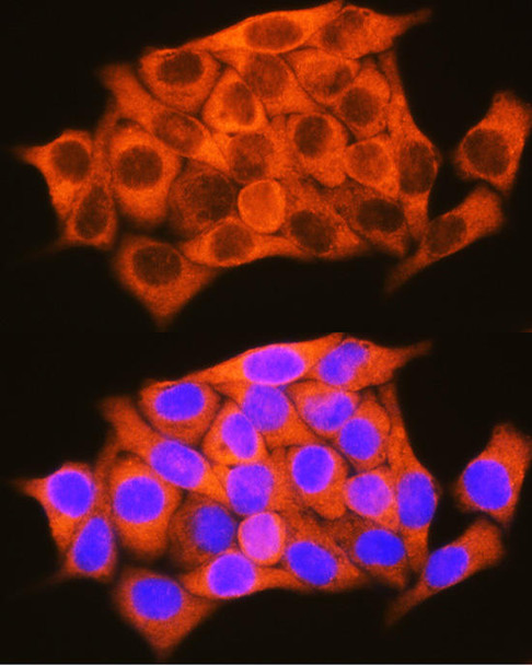 Signal Transduction Antibodies 1 Anti-RBP1 Antibody CAB10029