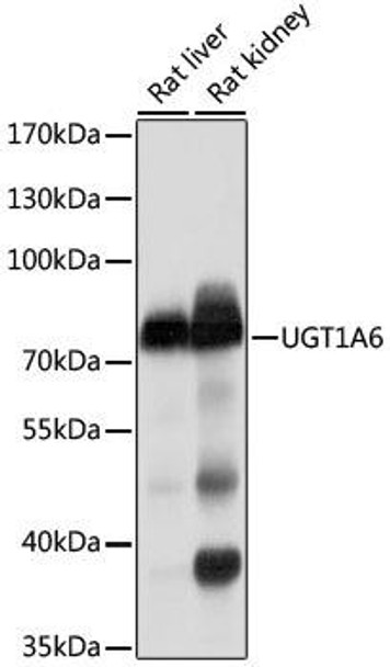 Cell Biology Antibodies 1 Anti-UGT1A6 Antibody CAB10033