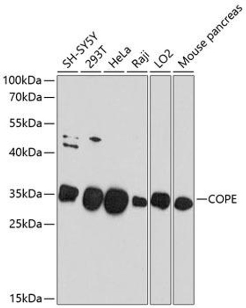 Cell Biology Antibodies 1 Anti-COPE Antibody CAB10047