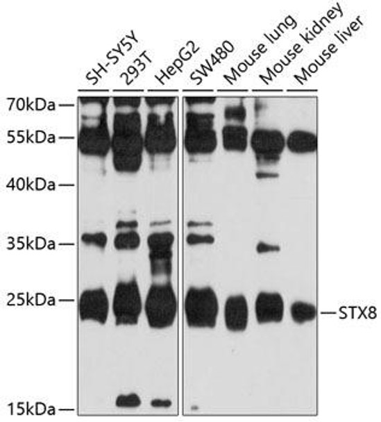 Signal Transduction Antibodies 1 Anti-STX8 Antibody CAB10050