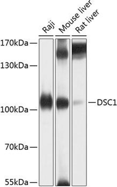 Cell Biology Antibodies 1 Anti-DSC1 Antibody CAB10061