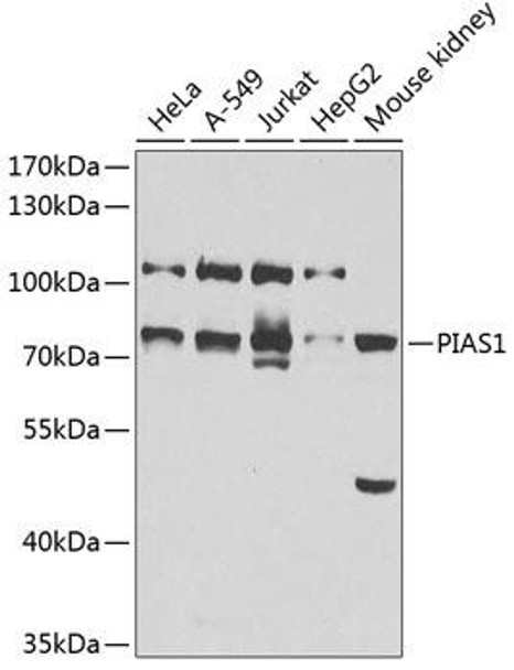 Epigenetics and Nuclear Signaling Antibodies 1 Anti-PIAS1 Antibody CAB1007