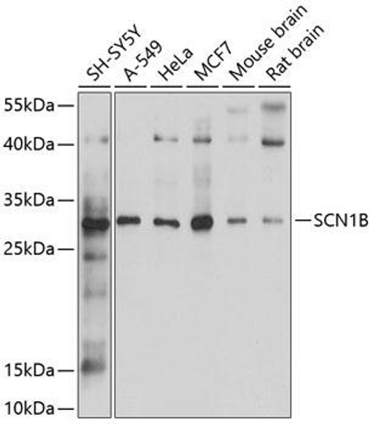 Cell Biology Antibodies 1 Anti-SCN1B Antibody CAB10071