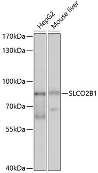 Signal Transduction Antibodies 1 Anti-SLCO2B1 Antibody CAB10073