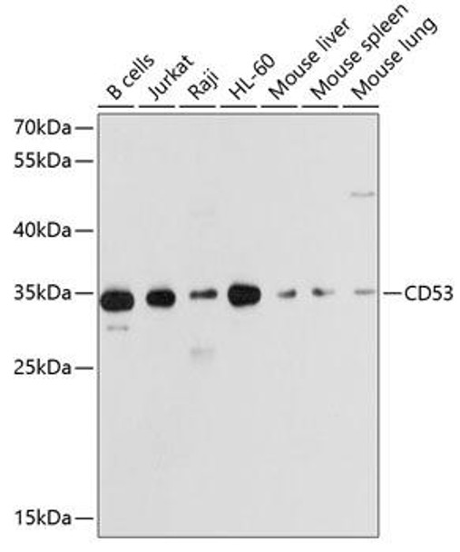 Cell Biology Antibodies 1 Anti-CD53 Antibody CAB10079
