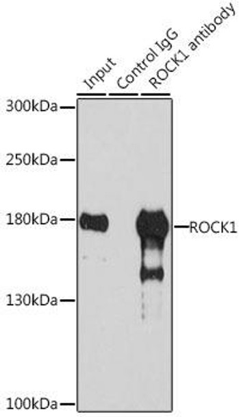 KO Validated Antibodies 1 Anti-ROCK1 Antibody CAB1008KO Validated