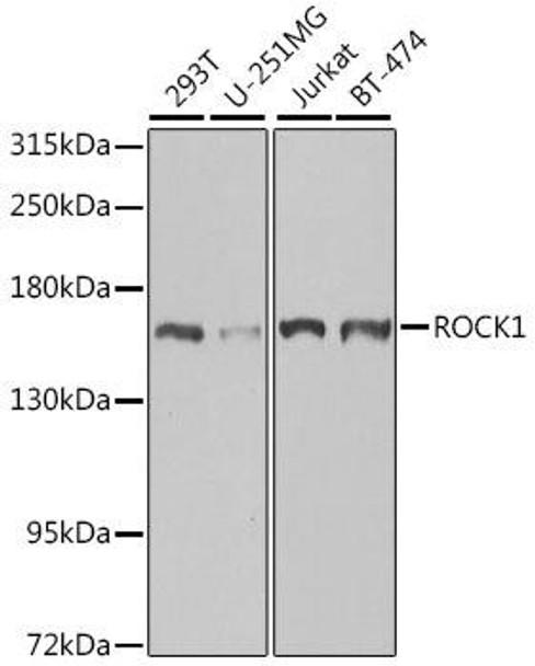 KO Validated Antibodies 1 Anti-ROCK1 Antibody CAB1008KO Validated