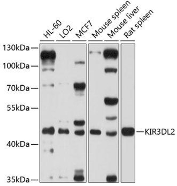 Cell Biology Antibodies 1 Anti-KIR3DL2 Antibody CAB10117
