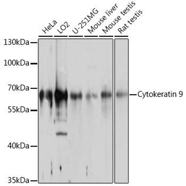 Cell Biology Antibodies 1 Anti-Cytokeratin 9 Antibody CAB10119