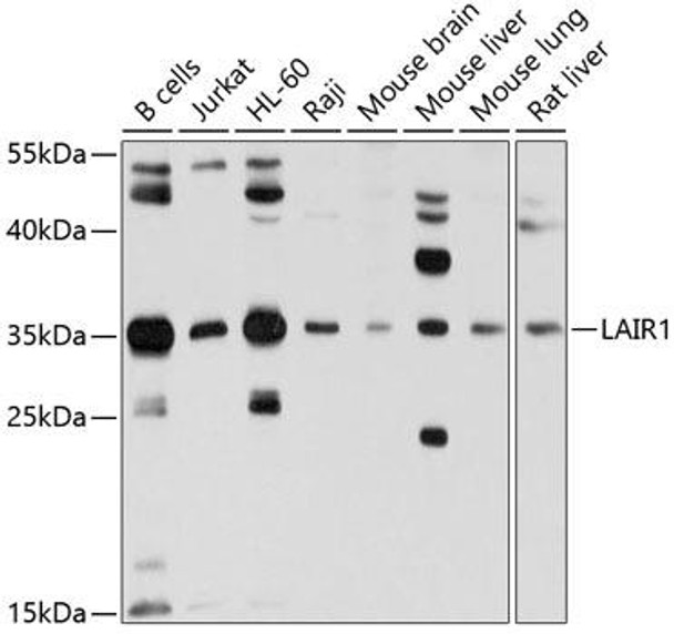Immunology Antibodies 1 Anti-LAIR1 Antibody CAB10120