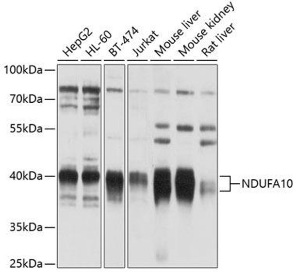 Cell Biology Antibodies 1 Anti-NDUFA10 Antibody CAB10123