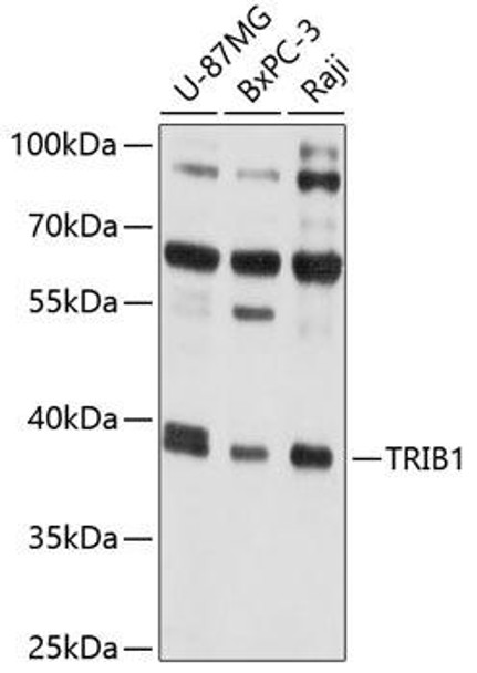 Cell Biology Antibodies 1 Anti-TRIB1 Antibody CAB10134