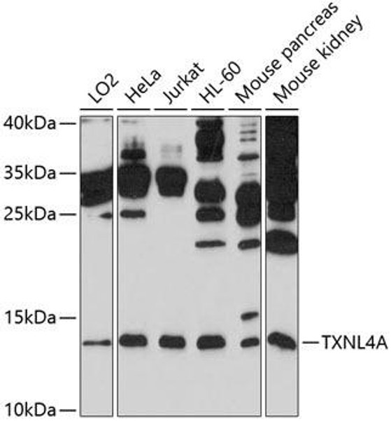 Cell Cycle Antibodies 1 Anti-TXNL4A Antibody CAB10138
