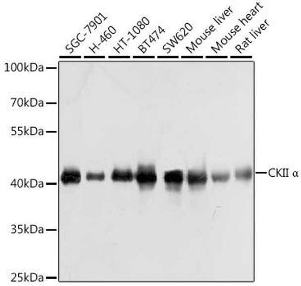 Cell Death Antibodies 1 Anti-CKII Alpha Antibody CAB1014
