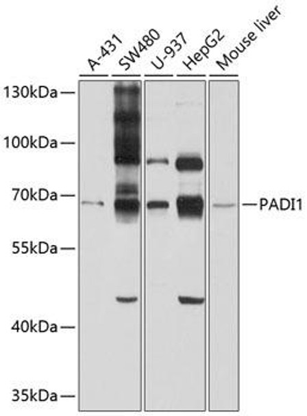 Cell Biology Antibodies 1 Anti-PADI1 Antibody CAB10145