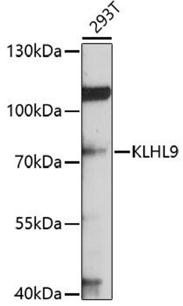 Cell Cycle Antibodies 1 Anti-KLHL9 Antibody CAB10149