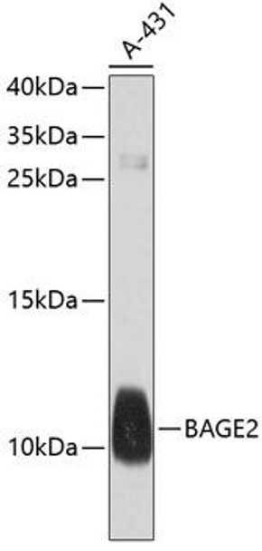 Cell Biology Antibodies 1 Anti-BAGE2 Antibody CAB10159