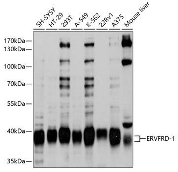 Cell Biology Antibodies 1 Anti-ERVFRD-1 Antibody CAB10162