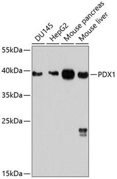 Epigenetics and Nuclear Signaling Antibodies 1 Anti-PDX1 Antibody CAB10173