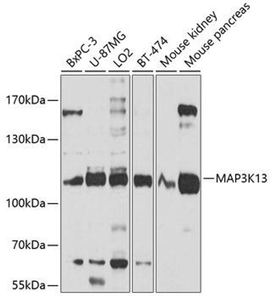 Cell Biology Antibodies 1 Anti-MAP3K13 Antibody CAB10189