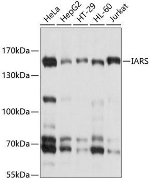 Metabolism Antibodies 1 Anti-IARS Antibody CAB10190