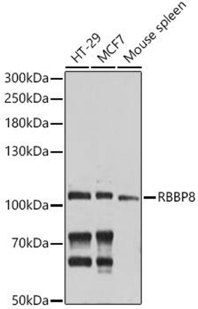 Cell Cycle Antibodies 1 Anti-RBBP8 Antibody CAB10201