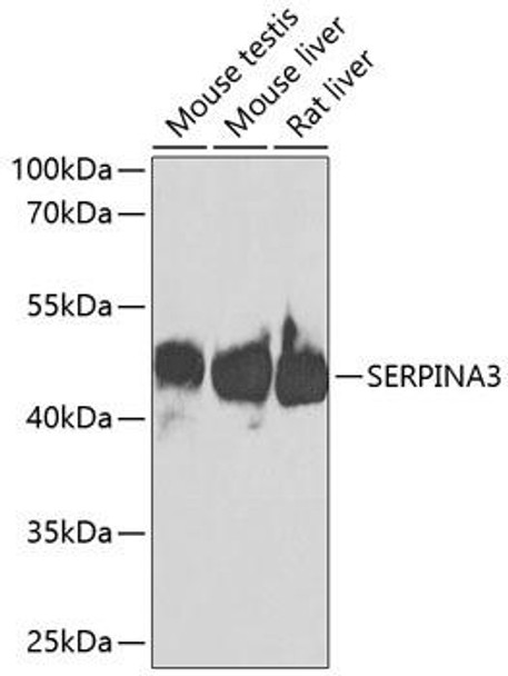 Immunology Antibodies 1 Anti-SERPINA3 Antibody CAB1021