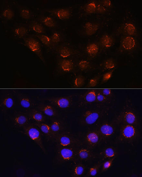 Cell Biology Antibodies 1 Anti-GOLGA4 Antibody CAB10216