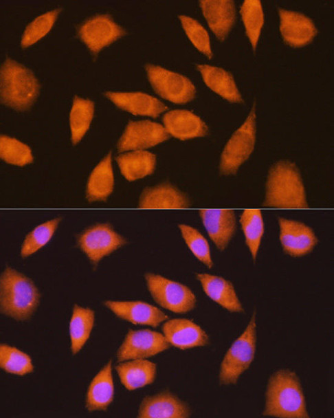 Cell Biology Antibodies 1 Anti-LY6E Antibody CAB10225