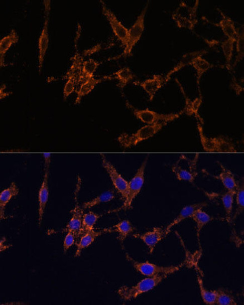 Immunology Antibodies 1 Anti-YWHAB Antibody CAB1023