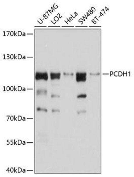Cell Biology Antibodies 1 Anti-PCDH1 Antibody CAB10234