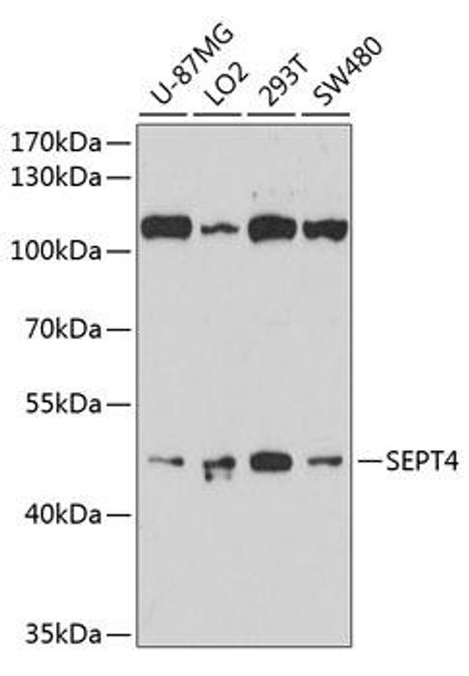 Cell Cycle Antibodies 1 Anti-SEPT4 Antibody CAB10238
