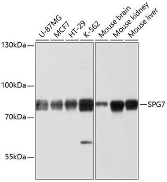 Cell Biology Antibodies 1 Anti-SPG7 Antibody CAB10249