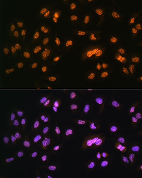 Epigenetics and Nuclear Signaling Antibodies 1 Anti-NR2F2 Antibody CAB10251