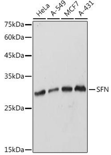 Cell Biology Antibodies 1 Anti-SFN Antibody CAB1026