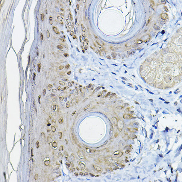 Cell Biology Antibodies 1 Anti-SFN Antibody CAB1026