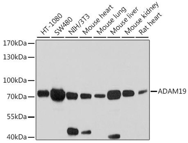 Cell Biology Antibodies 1 Anti-ADAM19 Antibody CAB10260