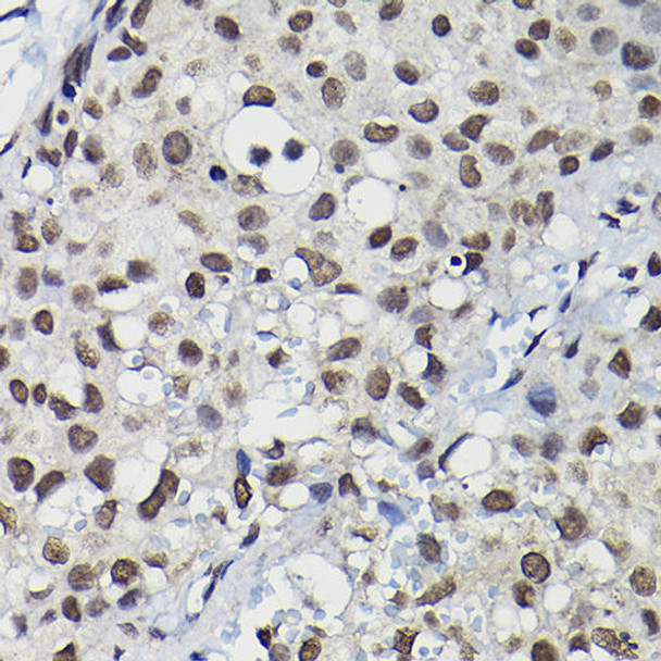 Cell Cycle Antibodies 1 Anti-Cyclin K Antibody CAB10261