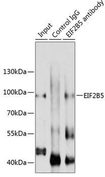 Metabolism Antibodies 1 Anti-EIF2B5 Antibody CAB10263