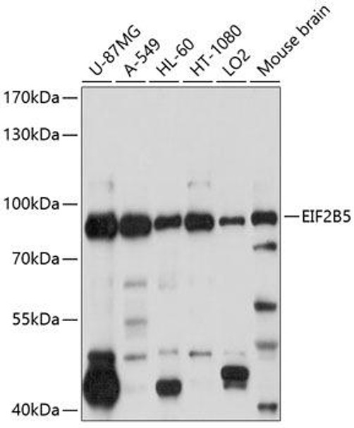 Metabolism Antibodies 1 Anti-EIF2B5 Antibody CAB10263