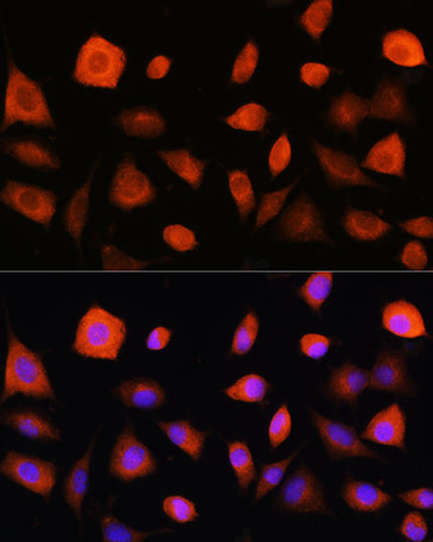 Metabolism Antibodies 1 Anti-EIF2B5 Antibody CAB10263