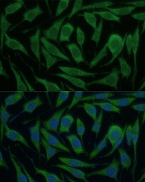 Cell Biology Antibodies 1 Anti-KIF14 Antibody CAB10275